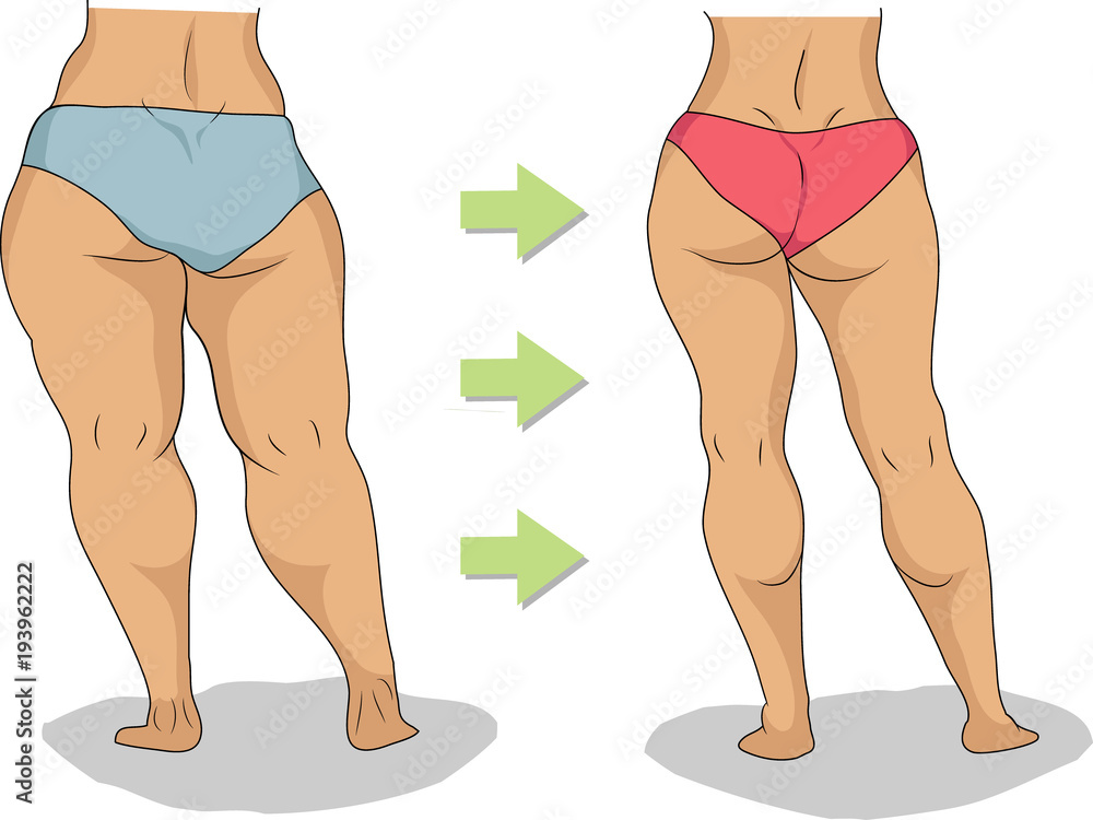 Butt and legs of thick and slim woman Stock Vector
