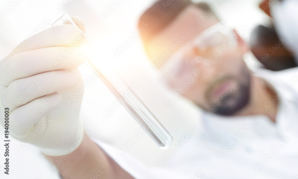image is blurred. young scientist holding tube with the reagents image is blurred. young scientist holding tube with the reagents