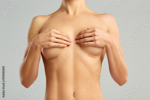 Plastic surgery of the female breast