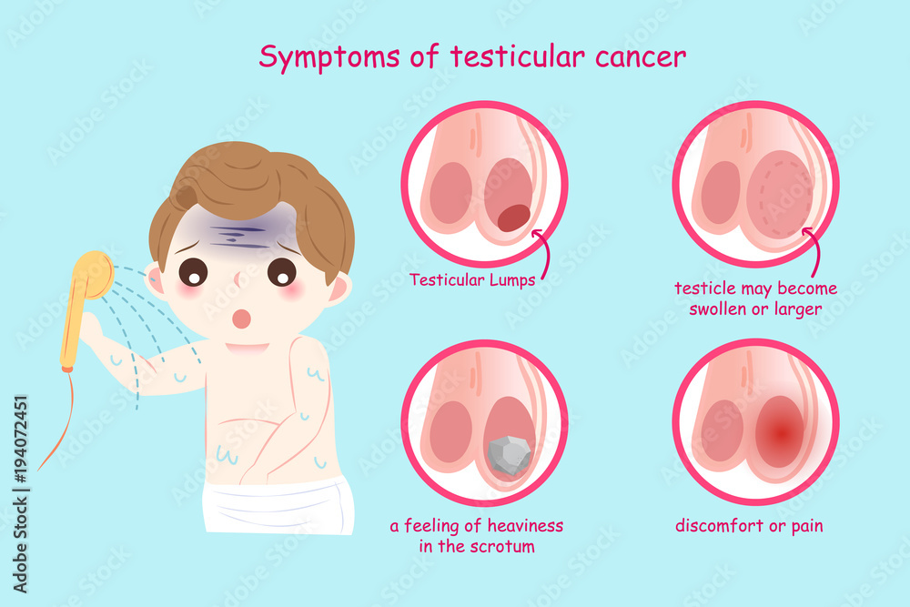 man with testicular cancer man with testicular cancer
