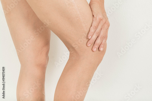 Fototapeta Naklejka Na Ścianę i Meble -  knee  pain in old women