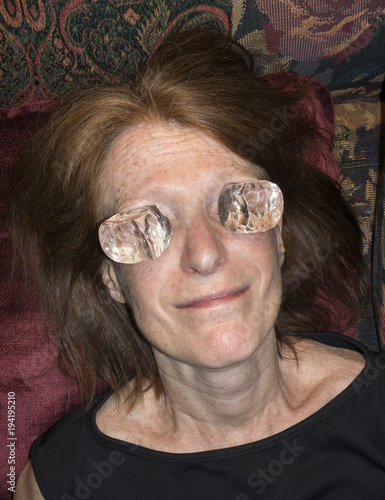 woman with ice on eyes