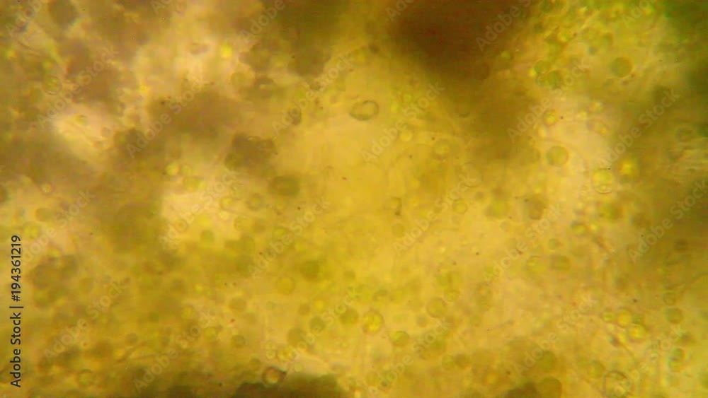 Microscopic view of organisms in the fusty water. Rotifers Microscopic view of organisms in the fusty water. Rotifers