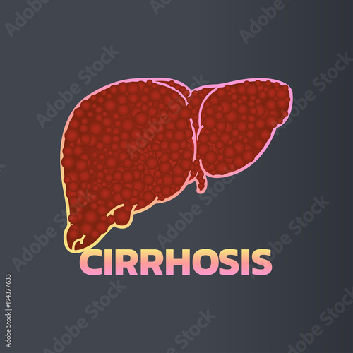 cirrhosis icon design, infographic health, medical infographic. Vector illustration