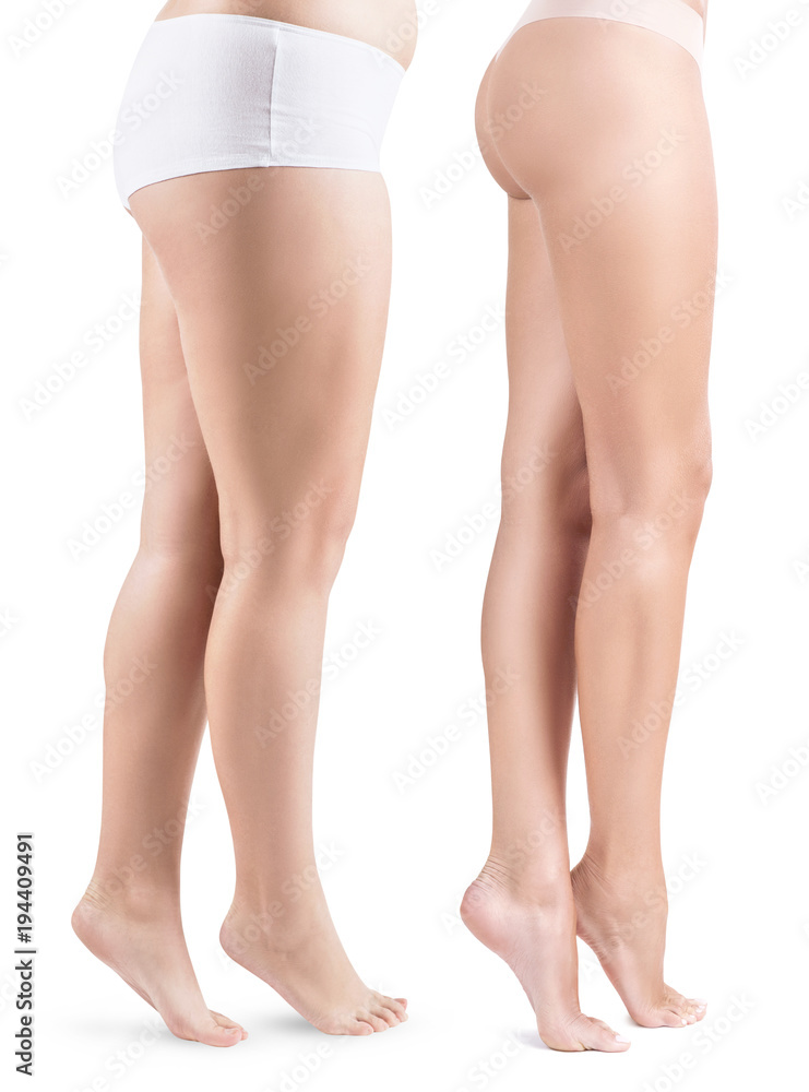 Side view on woman's legs before and after slimming. Stock Photo