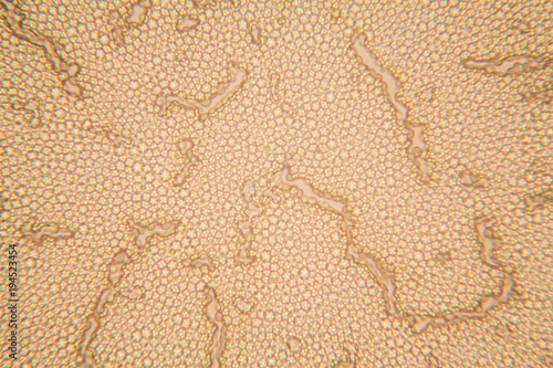 Yeast at the microscope
