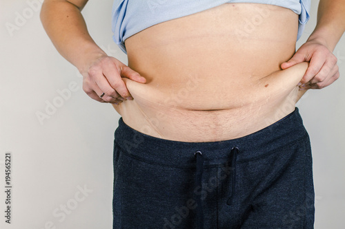 Excess skin on his stomach.