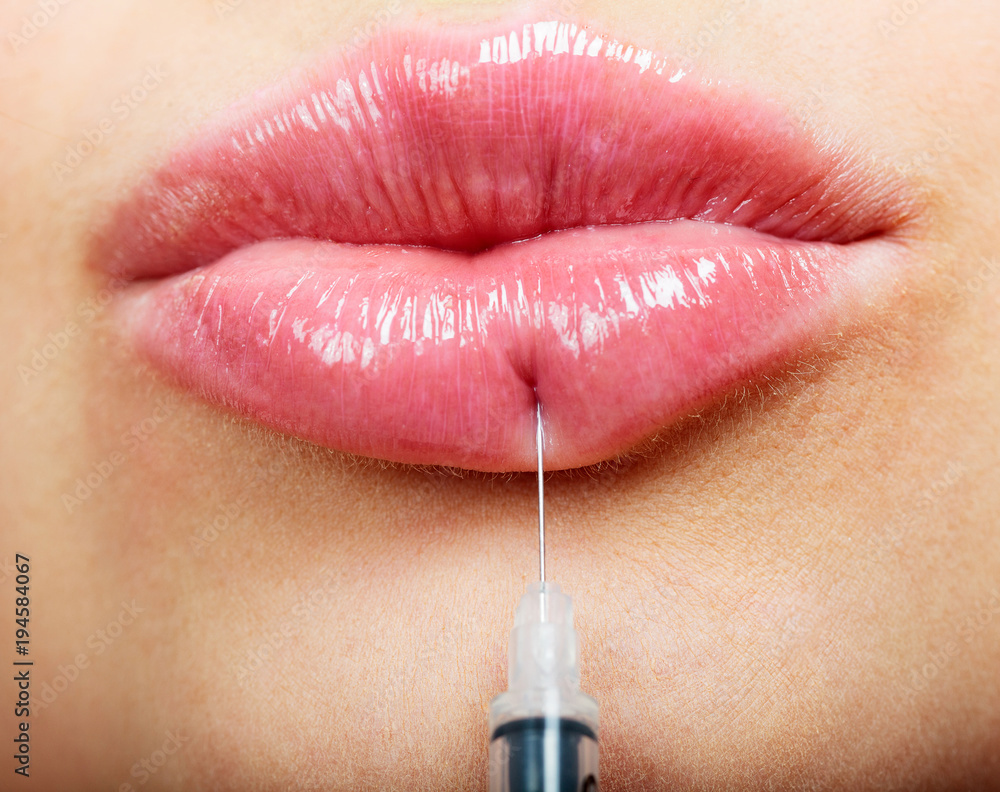 Obraz premium Closeup shot of beautiful female lips and syringe with filler
