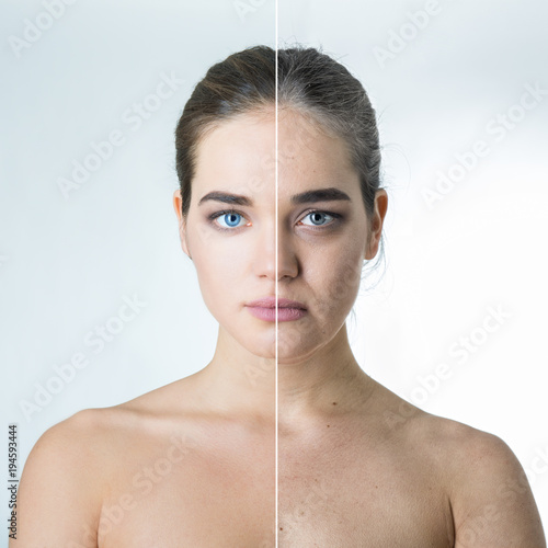 Anti-aging concept, portrait of beautiful woman with problem and clean skin, aging and youth concept, beauty treatment, plastic surgery, beauty shots. Female face before and after beauty treatment.