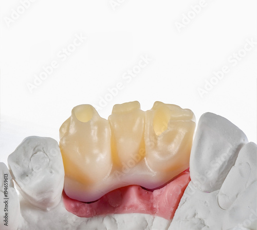 Technical shots of tooth prosthesis on a dental prothetic laboratory photo