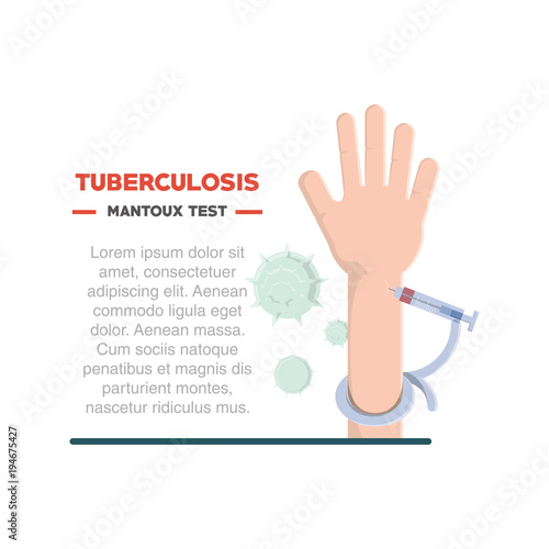 Tuberculosis infographic design with hand with mantoux test over white background, colorful design vector illustration photo