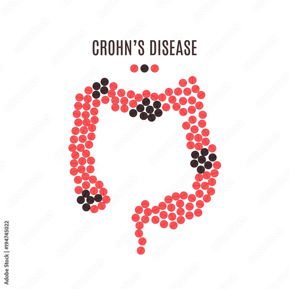 Crohn's disease awareness poster with intestine made of red and black pills on white background