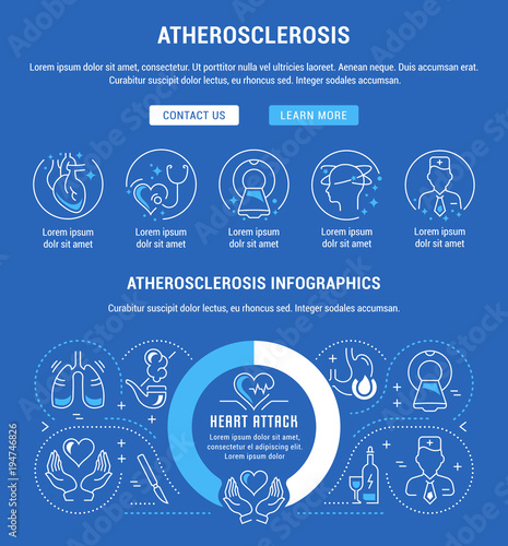 Website Banner and Landing Page of Atherosclerosis.