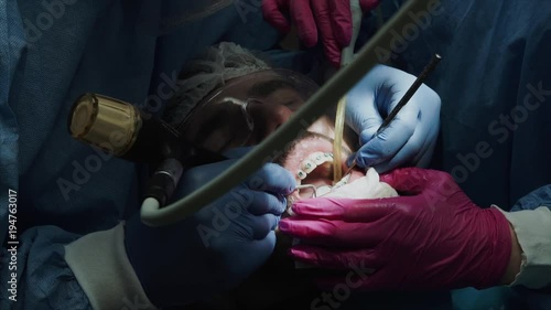 Dentists with a patient during a dental intervention to boy. Dentist Concept photo