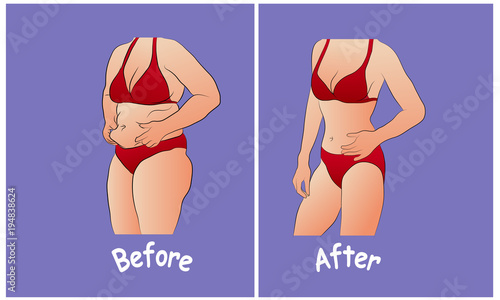 スリムな女性と比較脂肪腹を持つ赤い下着の女性. ダイエット前後の女性の体