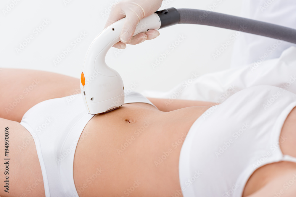 woman in underwear receiving laser hair removal procedure on stomach on  salon Stock Photo | Adobe Stock