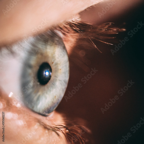 enlarged image of an eye iris made with a slit lamp