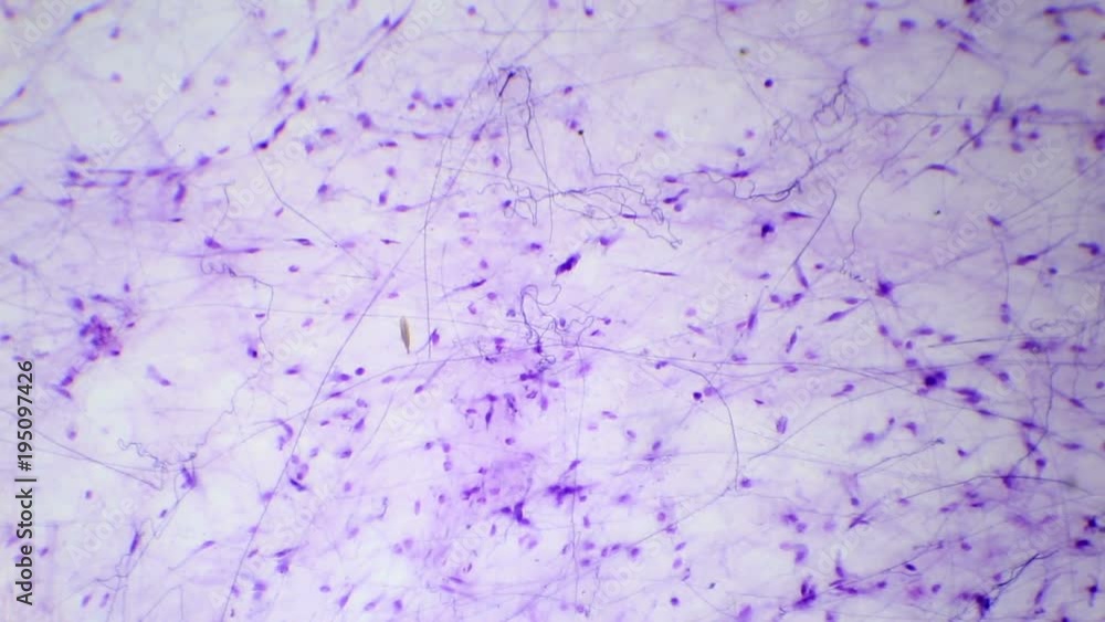Loose fibrous connective tissue under the microscope Stock Video