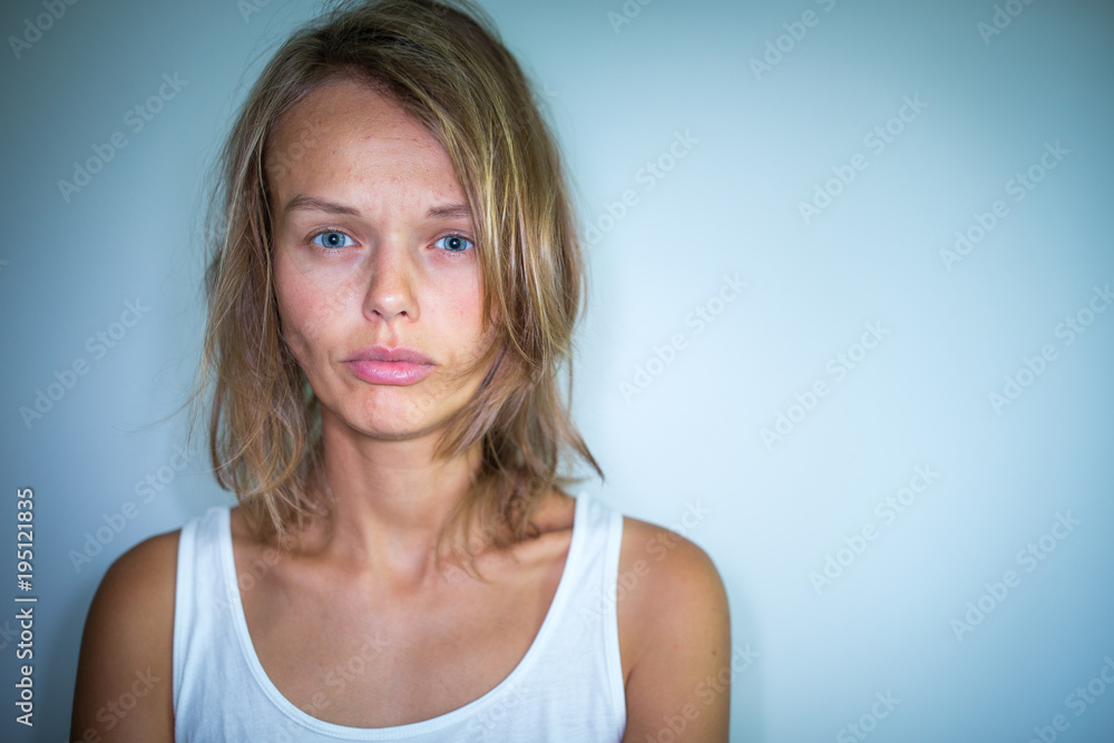 Young woman suffering from a severe depression, anxiety/sudden fear (very harsh lighting is used on this shot to underline/convey the gloomy mood of the scene; color toned image) Young woman suffering from a severe depression, anxiety/sudden fear (very harsh lighting is used on this shot to underline/convey the gloomy mood of the scene; color toned image)