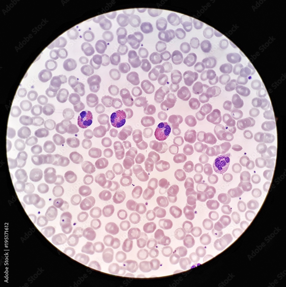 negative equal Quickly Human blood smear under 100X light microscope with Eosinophils, Neutrophil  and hypochromic red blood cells (Selective focus). Stock Photo | Adobe Stock
