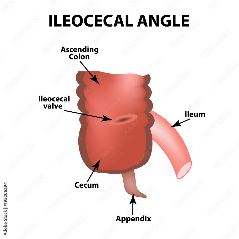 Ileocecal angle. Ileocecal valve. Bauginiev s damper. The ileum, the