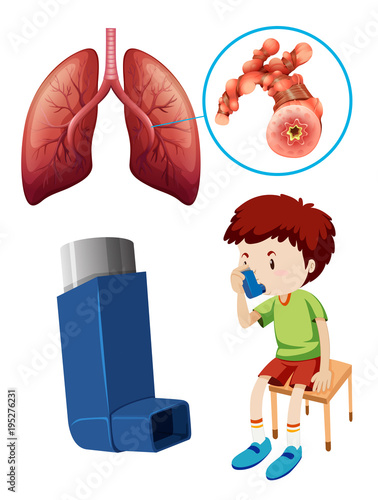 Boy with unhealthy lungs