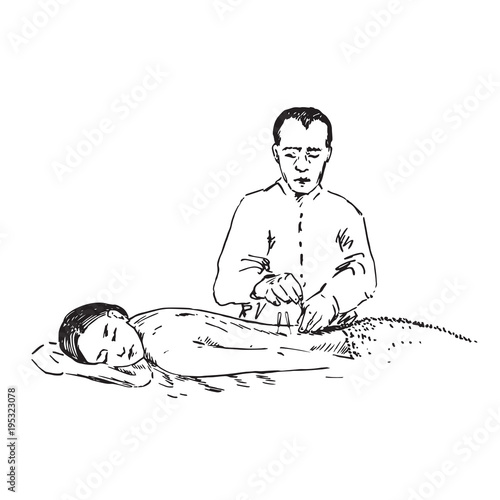 Doctor insert acupuncture needles in laying woman`s back, hand drawn doodle, sketch in pop art style, black and white medical vector illustration