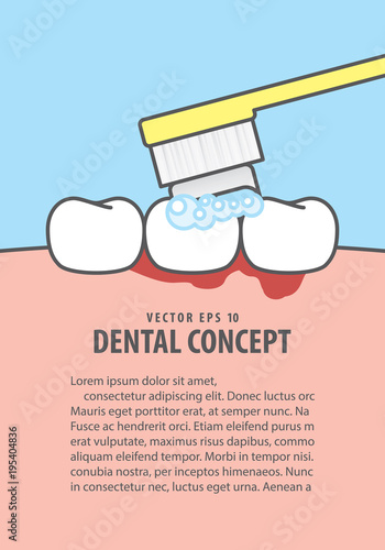 Layout Bleeding when brushing illustration vector on blue background. Dental concept.