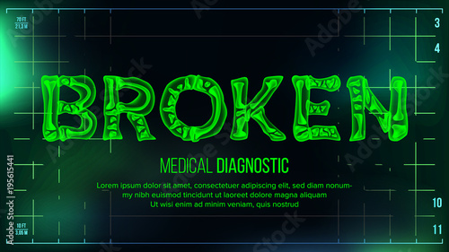 Broken Banner Vector. Medical Background. Transparent Roentgen X-Ray Text With Bones. Radiology 3D Scan. Medical Health Typography. Futuristic Technology Illustration