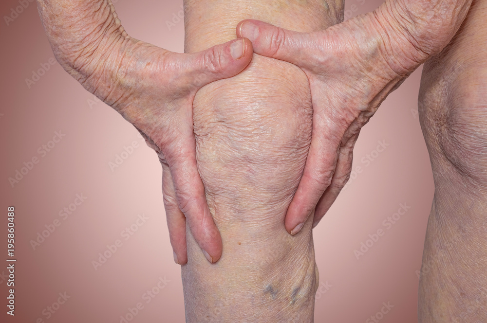 Fototapeta premium Senior woman holding the knee with pain