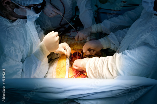 surgeons operating during cardiac operation of CABG
