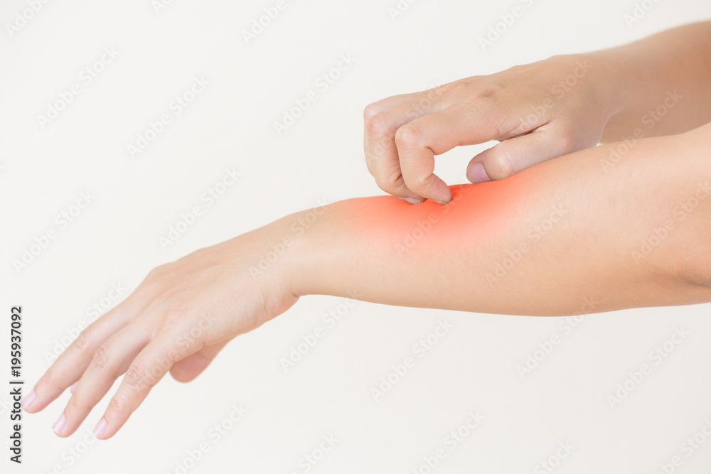 Close up woman hand scratch the itch by hand at home. Healthcare and medical concept. Close up woman hand scratch the itch by hand at home. Healthcare and medical concept.