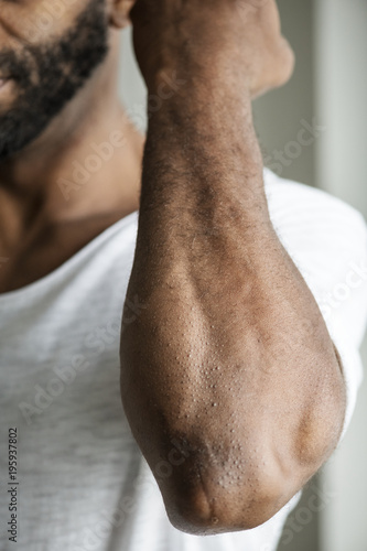Closeup of black person&#39;s arm