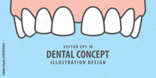 Banner Upper Diastema teeth illustration vector on blue background. Dental concept.