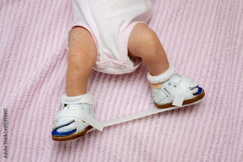 Newborn Orthopedic Shoes