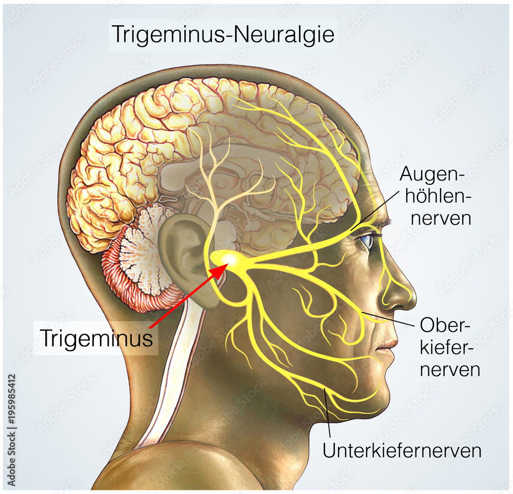 Trigeminusäste.Trigeminus-Neuralgie Stock Illustration | Adobe Stock