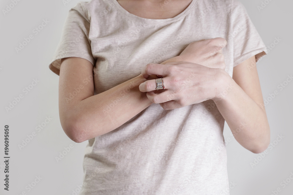 Close up view of woman scratching her arm. Health care and medical concept. Close up view of woman scratching her arm. Health care and medical concept.