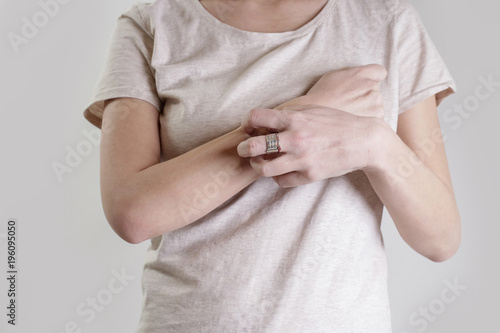 Close up view of woman scratching her arm. Health care and medical concept.
