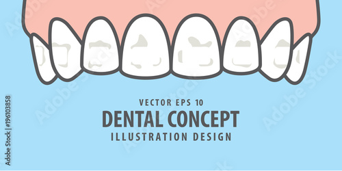 Banner Upper White spots on teeth illustration vector on blue background. Dental concept.