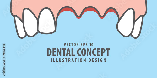 Banner Upper Lost teeth illustration vector on blue background. Dental concept.