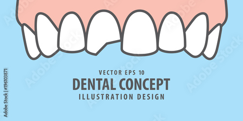 Banner Upper Chipped tooth illustration vector on blue background. Dental concept.
