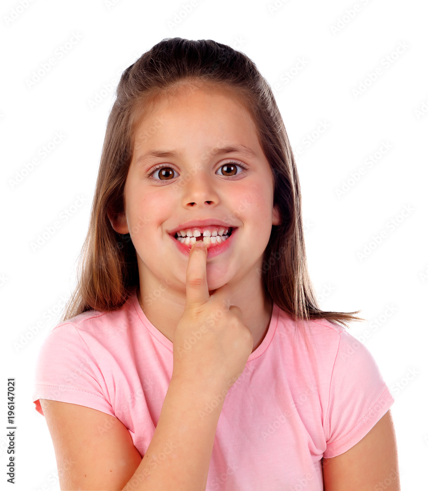 Friendly gril showing her broken teeth Friendly gril showing her broken teeth