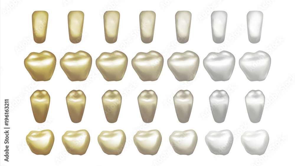Teeth Whitening Vector. Before And After View Of Teeth Whitening. Dental Technician Concept. Isolated Illustration Teeth Whitening Vector. Before And After View Of Teeth Whitening. Dental Technician Concept. Isolated Illustration