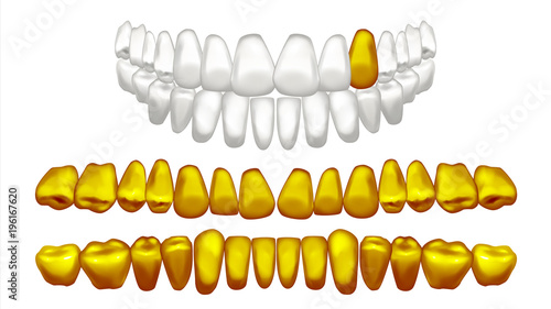 Gold Tooth Vector. Metal Golden Human Teeth. Old Pirate. Realistic Isolated Illustration