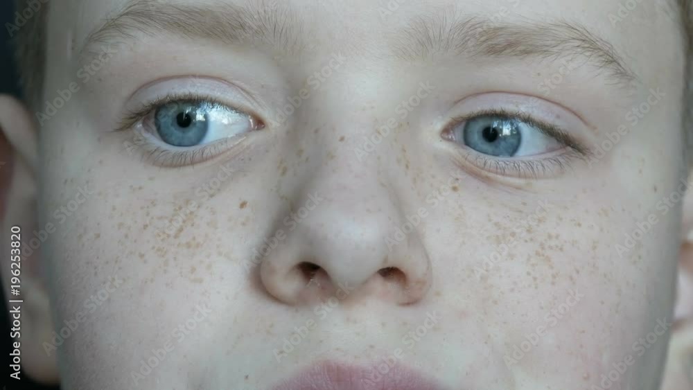 Thoughtful face blue-eyed teenage boy with freckles close up Thoughtful face blue-eyed teenage boy with freckles close up