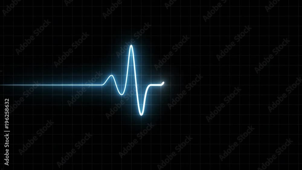 EKG 60 BPM Loop Screen, Blue w/ Grid. Heart rate monitor