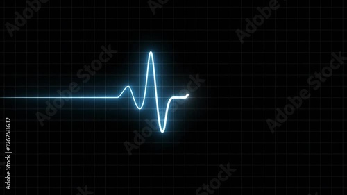 EKG 60 BPM Loop Screen, Blue w/ Grid. Heart rate monitor / electrocardiogram (EKG or ECG) loop beeping at 60 beats per minute for screen savers or computer monitor displays, animated at 60fps.