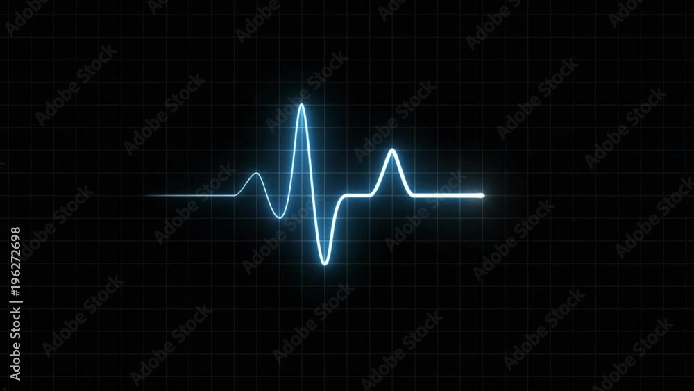 Video Stock EKG 120 BPM Loop Screen, Blue w/ Grid. Heart rate monitor