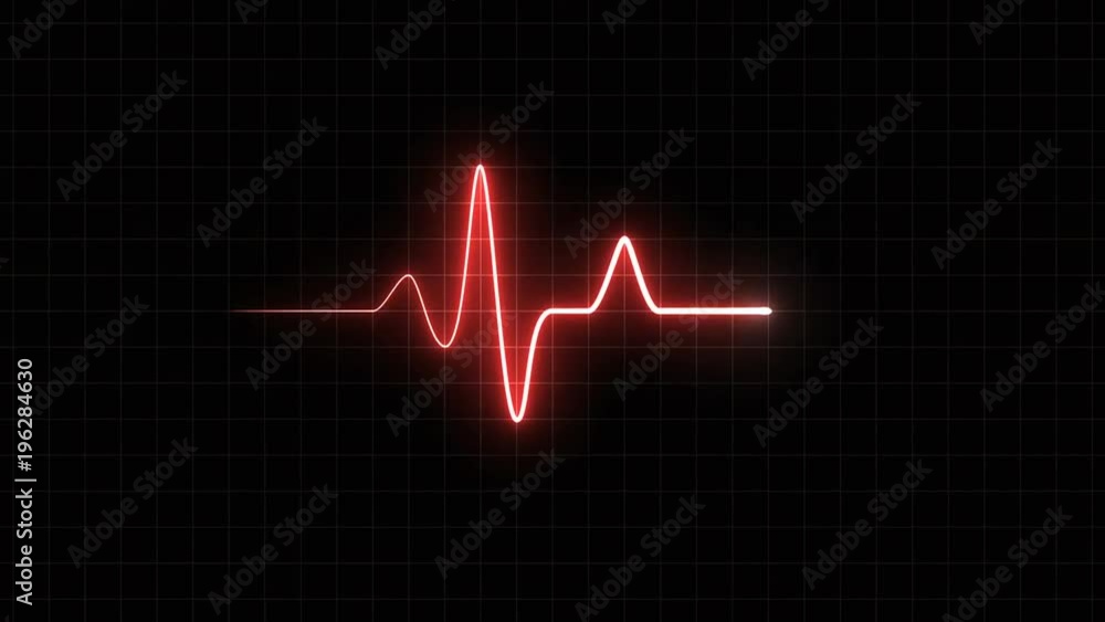 EKG 120 BPM Loop Screen, Red w/ Grid. Heart rate monitor