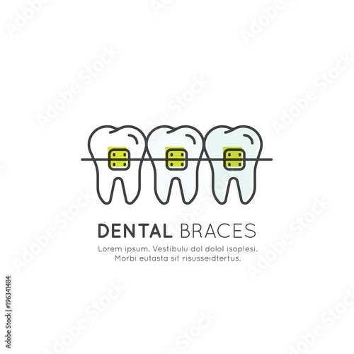 Vector Icon Style Illustration Logo Badge or Dental Tooth Braces Process, Aesthetics, Orthodontist, Isolated Web Element